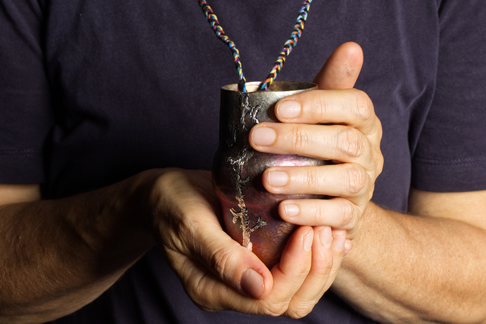 Ursula-Haehner_Mehrbettzimmer_Verletzungen_2024_02_960x640